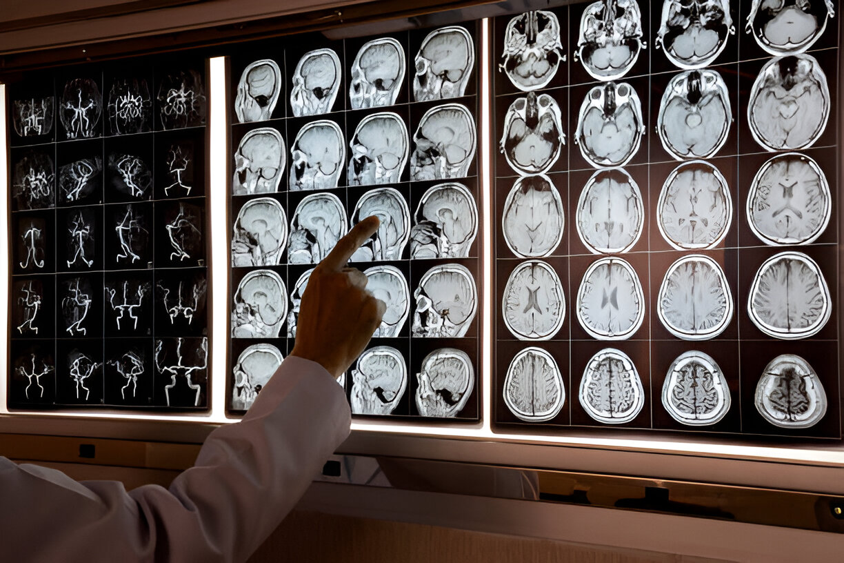 Doctor highlighting brain anatomy on an MRI