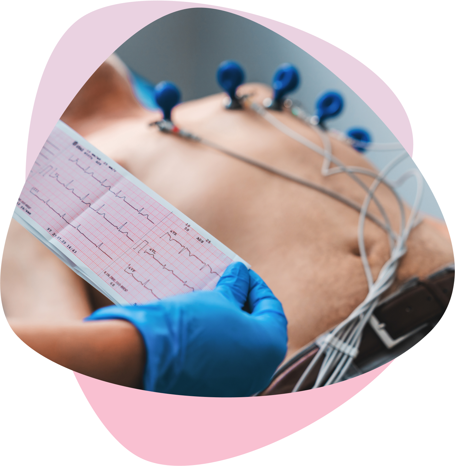 Doctor reviewing electrocardiogram