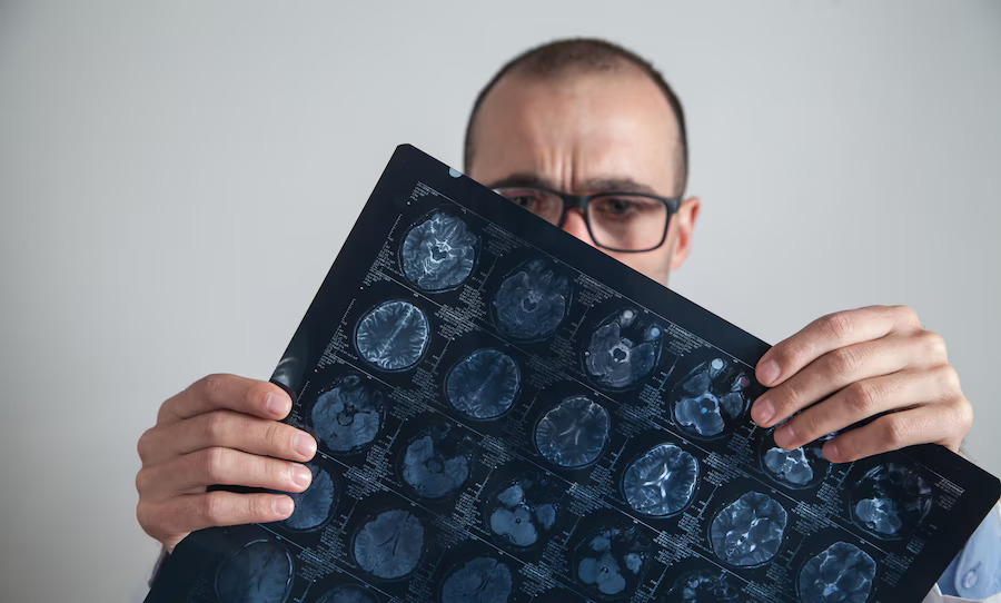 Doctor looking at x-ray picture of head to identify brain injury