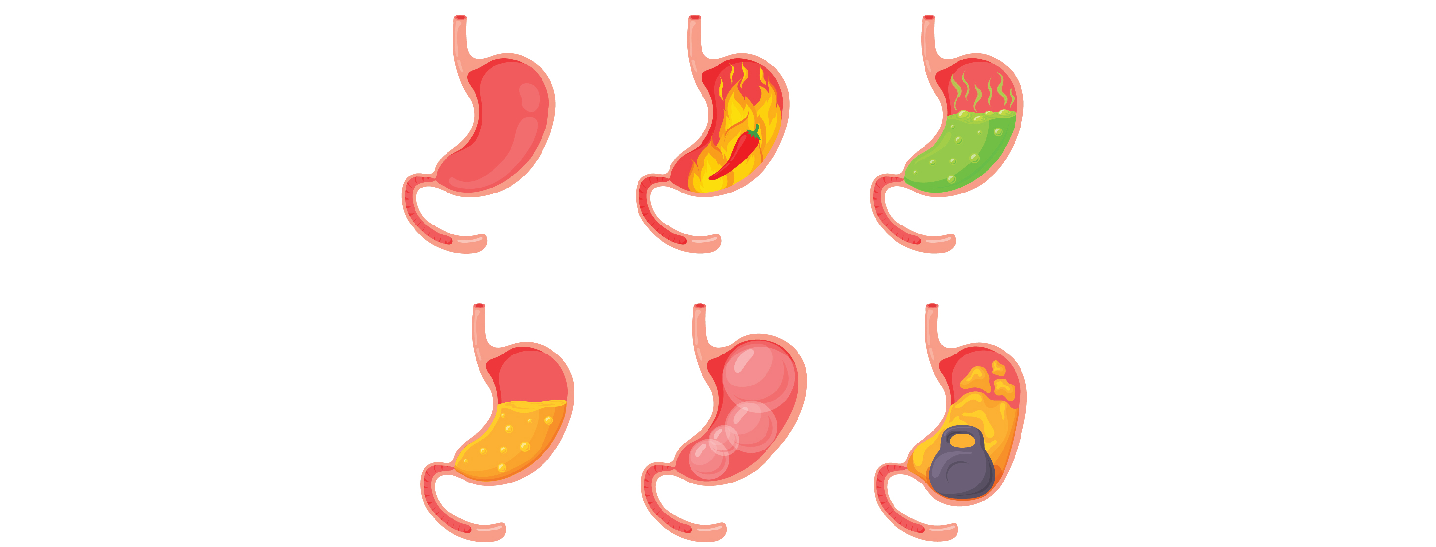 illustration depicting various causes of bloating