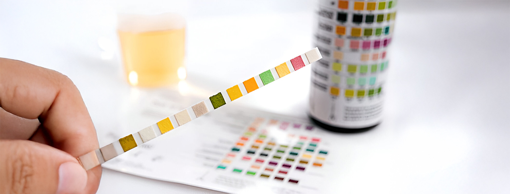 Understanding Urine Colors and What They Say About Your Kidney Health